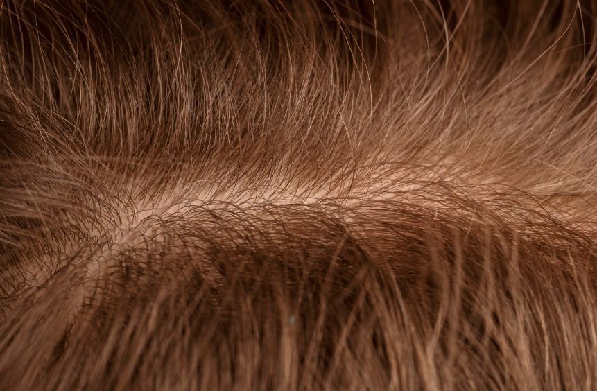 Afro Hair Systems – The Truth About Texture Matching